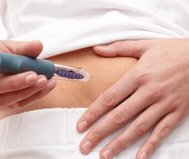 Weight Loss Therapies