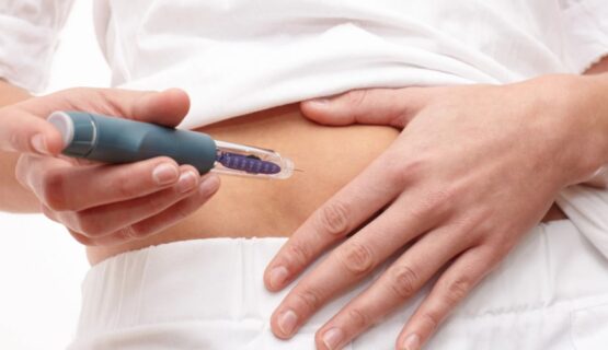 Weight Loss Therapies
